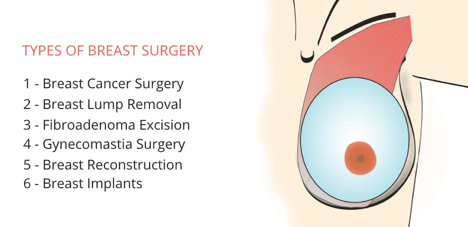 BREAST SURGERY